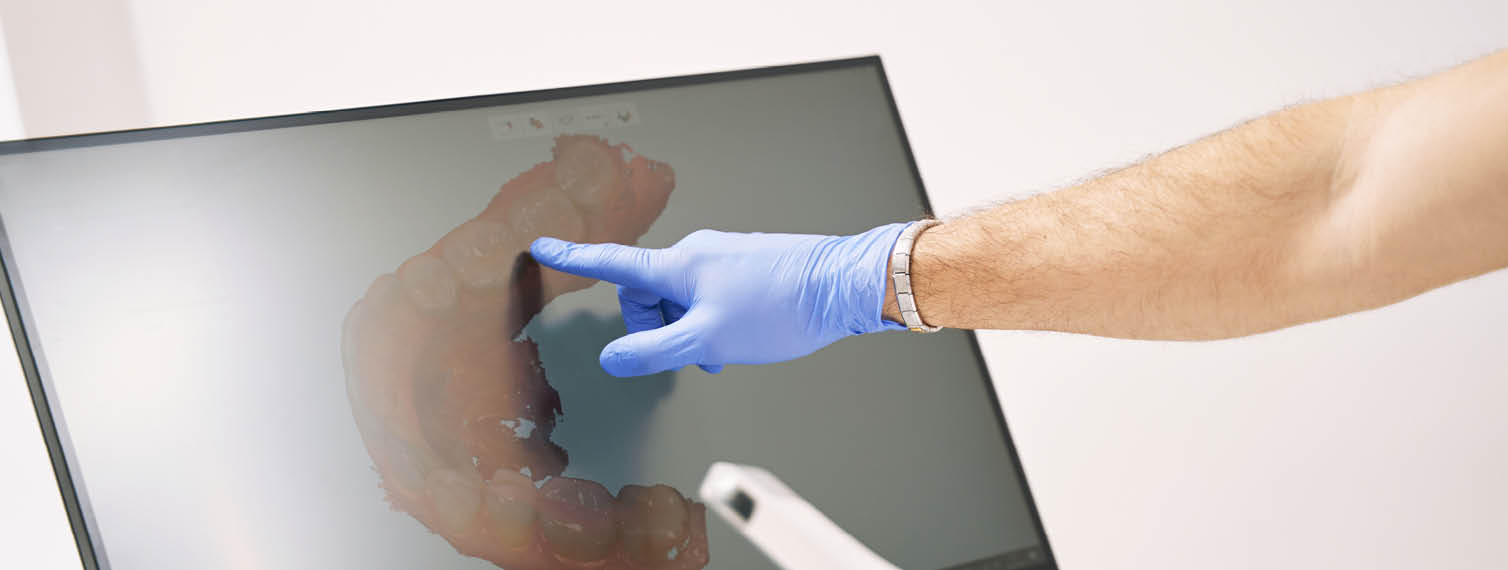 dentist hand pointing at computer display with dental 3D scan