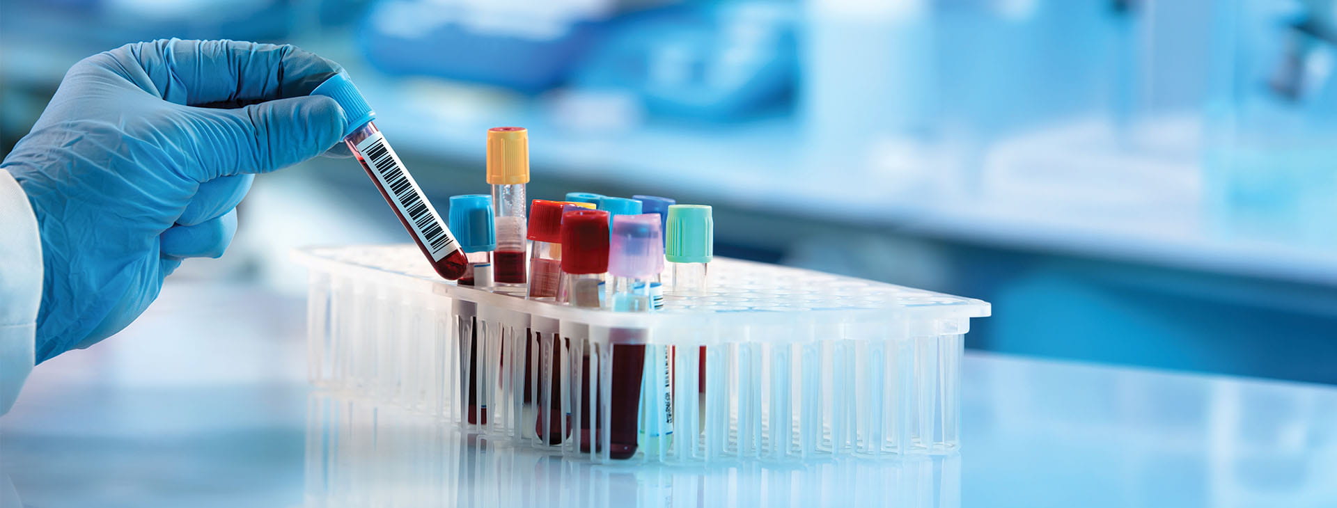 image of bio lab samples