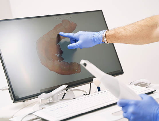 dentist hand pointing at computer display with dental 3D scan